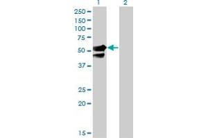 Western Blot analysis of AAK1 expression in transfected 293T cell line by AAK1 monoclonal antibody (M02), clone 4B10.