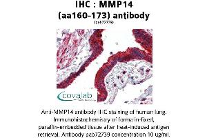 Image no. 1 for anti-Matrix Metallopeptidase 14 (Membrane-inserted) (MMP14) (AA 160-173) antibody (ABIN2852383) (MMP14 Antikörper  (AA 160-173))