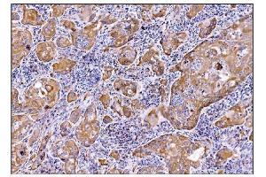 IHC analysis of DHPS/DHS using anti-DHPS/DHS antibody (ABIN7601998). (DHPS Antikörper  (AA 54-358))
