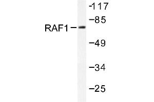 Image no. 1 for anti-V-Raf-1 Murine Leukemia Viral Oncogene Homolog 1 (RAF1) antibody (ABIN271937) (RAF1 Antikörper)