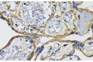 Immunohistochemistry of paraffin-embedded Human placenta using IQGAP1 Polyclonal Antibody at dilution of 1:200 (40x lens). (IQGAP1 Antikörper)