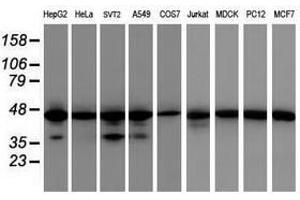 Image no. 1 for anti-Isocitrate Dehydrogenase 1 (NADP+), Soluble (IDH1) antibody (ABIN1502107) (IDH1 Antikörper)