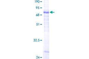 Sphingomyelin Synthase 1 Protein (SGMS1) (AA 1-413) (GST tag)