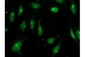 Immunofluorescent staining of HeLa cells using anti-FGF21 mouse monoclonal antibody (ABIN2454474). (FGF21 Antikörper  (AA 29-209))