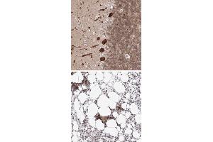 Immunohistochemical staining of human bone marrow with KIF4A polyclonal antibody  shows strong nuclear positivity in hematopoietic cells at 1:50-1:200 dilution. (KIF4A Antikörper)