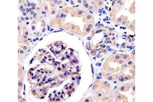 Immunohistochemistry (IHC) image for anti-Receptor Tyrosine Kinase-Like Orphan Receptor 1 (ROR1) antibody (ABIN3032439)