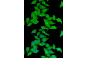 Immunofluorescence analysis of U20S cell using STK3 antibody. (STK3 Antikörper)