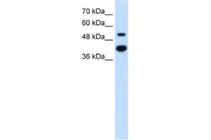 Western Blotting (WB) image for anti-Matrix Metallopeptidase 1 (Interstitial Collagenase) (MMP1) antibody (ABIN2462518) (MMP1 Antikörper)
