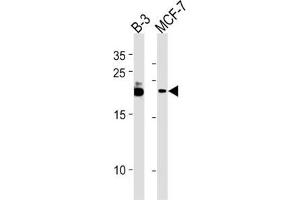 Western Blotting (WB) image for anti-Chromosome 13 Open Reading Frame 30 (C13orf30) antibody (ABIN3004687) (C13orf30 Antikörper)