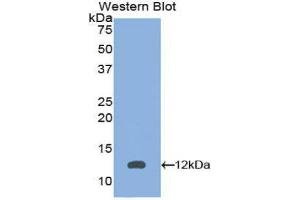 Western Blotting (WB) image for anti-Peroxisomal Biogenesis Factor 2 (PEX2) (AA 28-118) antibody (ABIN1860187)