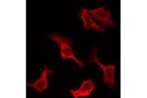 ABIN6276906 staining HuvEc by IF/ICC. (IL-10RA Antikörper  (C-Term))