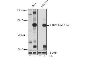 Western blot analysis of extracts of various cell lines, using Phospho-TBK1/NAK-S172 Rabbit mAb (ABIN7270721) at 1:1000 dilution. (TBK1 Antikörper  (pSer172))