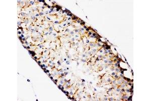 IHC-P: TBK1 antibody testing of rat testis tissue (TBK1 Antikörper  (C-Term))