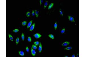 Immunofluorescent analysis of A549 cells using ABIN7163589 at dilution of 1:100 and Alexa Fluor 488-congugated AffiniPure Goat Anti-Rabbit IgG(H+L) (CD42a Antikörper  (AA 17-88))