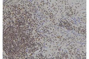 Immunohistochemistry (IHC) image for anti-BTB and CNC Homology 1, Basic Leucine Zipper Transcription Factor 1 (BACH1) (Internal Region) antibody (ABIN6260184)