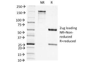 SDS-PAGE Analysis Purified CD11c Mouse Monoclonal Antibody (ITGAX/1242). (CD11c Antikörper  (AA 637-827))