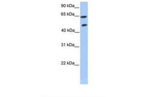 Image no. 1 for anti-Zinc Finger Protein 449 (ZNF449) (AA 199-248) antibody (ABIN6739105) (ZNF449 Antikörper  (AA 199-248))