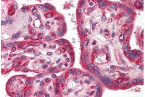 Human Placenta (formalin-fixed, paraffin-embedded) stained with SKIL antibody ABIN214478 at 2. (SKIL Antikörper  (N-Term))