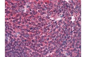 Human Tonsil: Formalin-Fixed, Paraffin-Embedded (FFPE) (BIRC3 Antikörper)