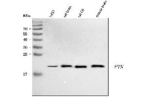 Western blot analysis of PTN using anti-PTN antibody (ABIN7602164).