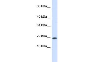 WB Suggested Anti-GABARAPL2 Antibody Titration: 0. (GABARAPL2 Antikörper  (N-Term))