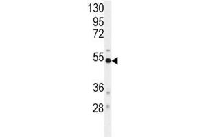 Western Blotting (WB) image for anti-Beta-secretase 1 (BACE1) (AA 476-501) antibody (ABIN3030158)