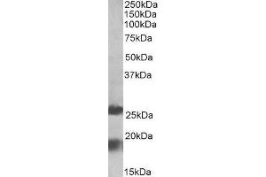 ABIN2563919 (2µg/ml) staining of Human Frontal Cortex lysate (35µg protein in RIPA buffer). (MPV17 Antikörper  (Internal Region))
