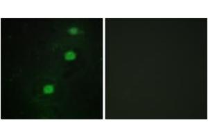 Immunofluorescence analysis of HuvEc cells, using CCRK Antibody. (CCRK Antikörper  (AA 31-80))