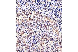 Immunohistochemical analysis of paraffin-embedded H. (CSE1L Antikörper  (N-Term))