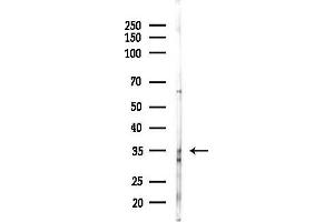 anti-Deoxyribose-Phosphate Aldolase (DERA) antibody