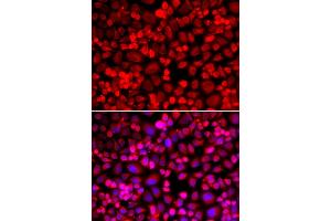 Immunofluorescence analysis of A549 cells using ANLN antibody (ABIN5973909). (Anillin Antikörper)