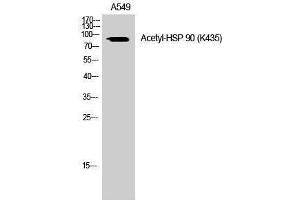 Western Blotting (WB) image for anti-Heat Shock Protein 90 (HSP90) (acLys435) antibody (ABIN6285498) (HSP90 Antikörper  (acLys435))