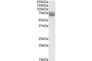Western Blotting (WB) image for anti-Tripeptidyl Peptidase I (TPP1) (Internal Region) antibody (ABIN2464251) (TPP1 Antikörper  (Internal Region))