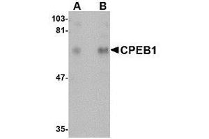 Image no. 1 for anti-Cytoplasmic Polyadenylation Element Binding Protein 1 (CPEB1) (N-Term) antibody (ABIN342681) (CPEB1 Antikörper  (N-Term))