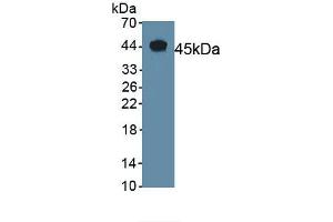 Detection of Recombinant CGRP, Mouse using Polyclonal Antibody to Calcitonin Gene Related Peptide (CGRP) (CGRP Antikörper  (AA 1-130))