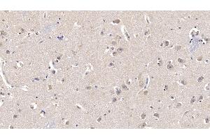 Detection of FGF13 in Human Cerebrum Tissue using Monoclonal Antibody to Fibroblast Growth Factor 13 (FGF13)