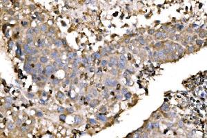 IHC analysis of EVL using anti-EVL antibody (ABIN7600986). (EVL Antikörper  (AA 268-400))
