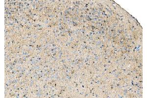 IHC analysis of Ezrin/EZR using anti-Ezrin/EZR antibody (ABIN7603214). (Ezrin Antikörper  (N-Term))