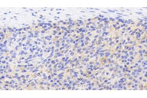 Detection of CD40L in Porcine Spleen Tissue using Polyclonal Antibody to Cluster Of Differentiation 40 Ligand (CD40L) (CD40 Ligand Antikörper  (AA 111-261))