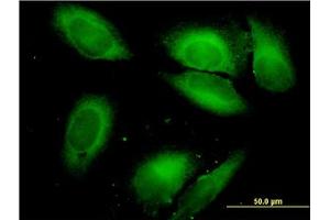 Image no. 5 for anti-Serine--tRNA Ligase, Cytoplasmic-Like (AA 1-515) antibody (ABIN598916) (Serine--tRNA Ligase, Cytoplasmic-Like (AA 1-515) Antikörper)
