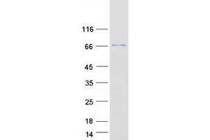 Validation with Western Blot (ASTE1 Protein (Myc-DYKDDDDK Tag))