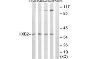 Western blot analysis of extracts from MCF-7/HuvEc/A549/LOVO cells, using HOXB2 Antibody.