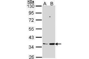 WB Image Sample (30 ug of whole cell lysate) A: 293T B: Molt-4 , 10% SDS PAGE antibody diluted at 1:1000 (PTGES2 Antikörper)
