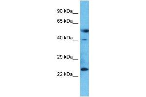 Host:  Rabbit  Target Name:  LAMP5  Sample Type:  Placenta lysates  Antibody Dilution:  1. (LAMP5 Antikörper  (Middle Region))