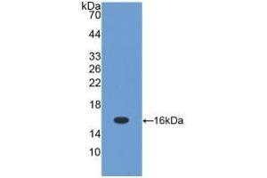Detection of Recombinant TGFb1, Mouse using Polyclonal Antibody to Transforming Growth Factor Beta 1 (TGFb1) (TGFB1 Antikörper  (AA 279-390))