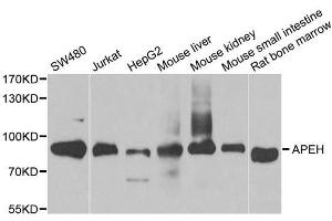 Western blot analysis of extracts of various cell lines, using APEH antibody. (APEH Antikörper  (AA 1-260))
