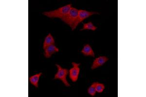 ABIN6265617 and ABIN6273082 staining HepG2 by IF/ICC.