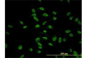 Immunofluorescence of monoclonal antibody to CMAS on HeLa cell. (CMAS Antikörper  (AA 164-263))