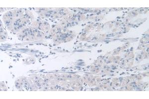 Detection of b4GALNT2 in Human Stomach Tissue using Polyclonal Antibody to Beta-1,4-N-Acetyl Galactosaminyl Transferase 2 (b4GALNT2) (B4GALNT2 Antikörper  (AA 324-566))