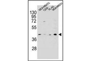 Western blot analysis of HHLA2 Antibody (N-term) in MDA-MB453, CEM, HL-60, MDA-MB231 cell line lysates (35ug/lane). (HHLA2 Antikörper  (N-Term))